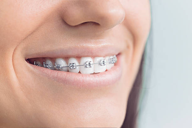 Best Invisalign and Clear Aligners  in La Mesilla, NM